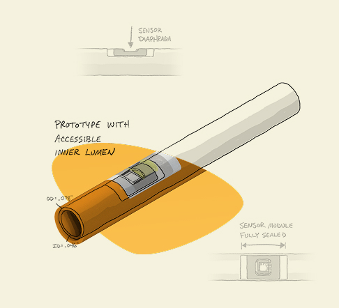 Illustrated catheter prototype with accessible inner lumen and embedded sensor module on an orange abstract background.